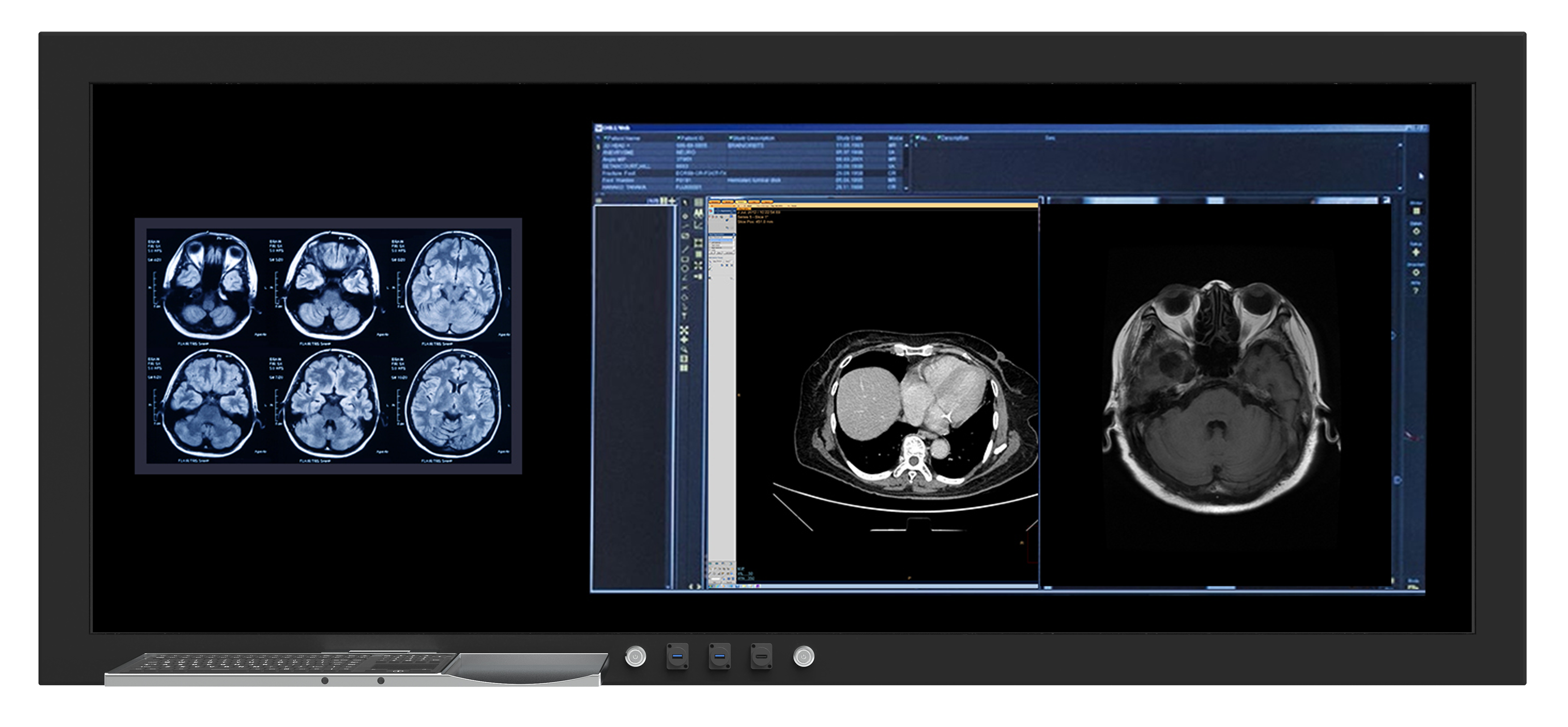 43h系列手术室一体化显示器55h系列手术室一体化显示器没有更多了